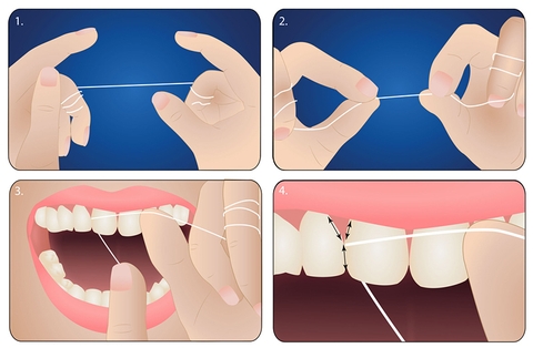 Chỉ Nha Khoa Jomi Dental Floss Hương Bạc Hà - 50m.