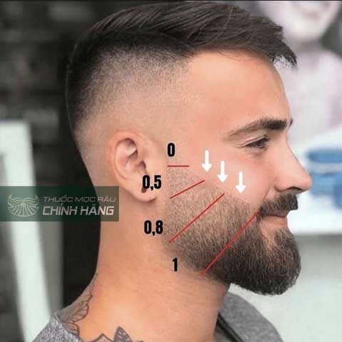 Tại sao không nên cạo râu khi dùng Minoxidil ?