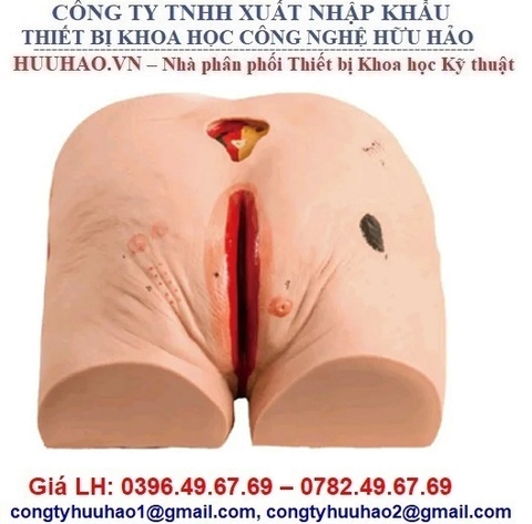 MÔ HÌNH CHĂM SÓC VẾT LOÉT GD/H90E