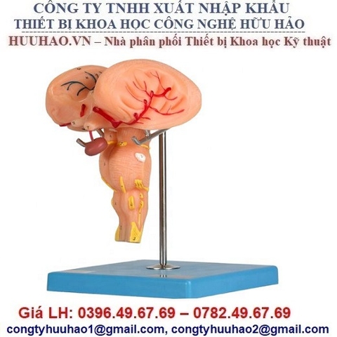 MÔ HÌNH GIẢI PHẪU THÂN NÃO GD/A18215