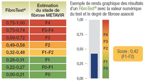 FIBROTEST - PHƯƠNG PHÁP MỚI CHẨN ĐOÁN CHÍNH XÁC XƠ GAN