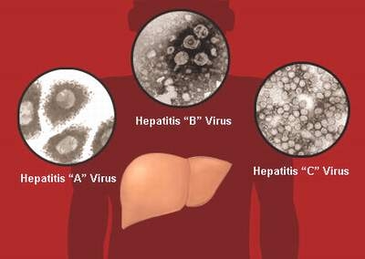 VIÊM GAN C CÓ BỊ LÂY QUA ĂN UỐNG HAY KHÔNG?