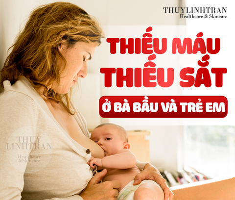 Thiếu máu thiếu sắt ở bà bầu và trẻ em