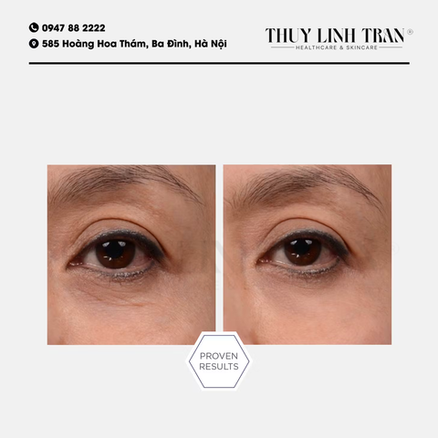 ZO Eye Brightening Cream 15g/Kem mắt