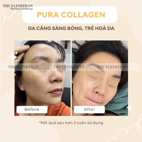 PURA COLLAGEN Glow+ 284g