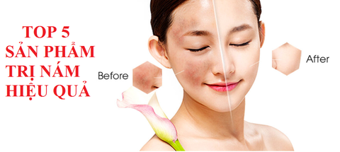 TOP 5 KEM TRỊ NÁM AN TOÀN NHẤT CHUYÊN GIA KHUYÊN DÙNG NĂM 2022