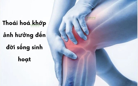 Thoái hoá khớp ảnh hưởng đến đời sống sinh hoạt như thế nào?