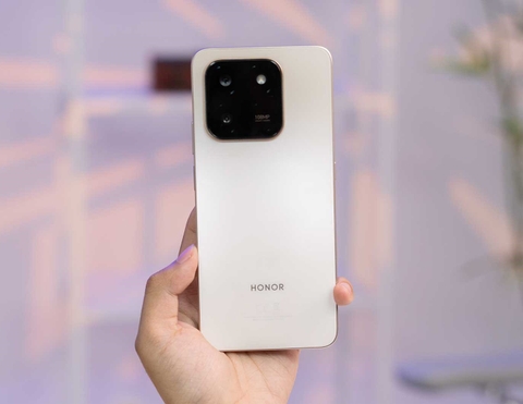 HONOR X7d – Pin 6.500 mAh, Camera 108 MP, Siêu Bền Cho Người Dùng Thực Dụng