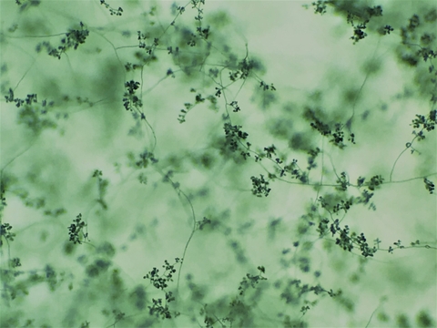 Trichoderma – phương pháp phòng trừ nấm bệnh sinh học tối ưu
