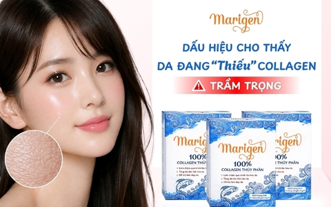 3 DẤU HIỆU “ÂM THẦM” CẢNH BÁO LÀN DA BẠN ĐANG THIẾU COLLAGEN NGHIÊM TRỌNG
