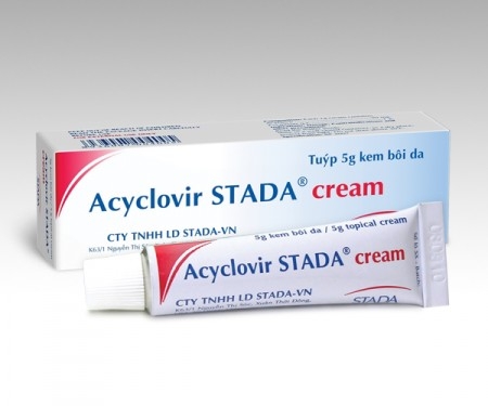 Acyclovir Tuýp 5g