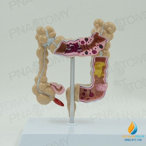 Mô hình giải phẫu ruột già của con người, mô hình ruột già, nhựa PVC cao cấp