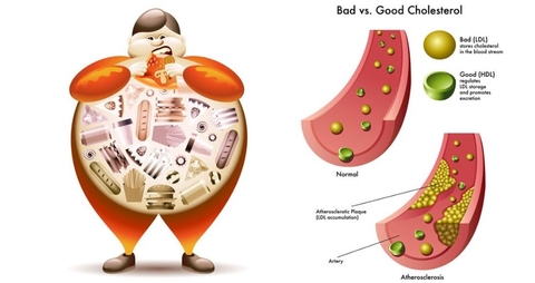 10 Cách Đơn Giản giảm Cholesterol, Triglyceride tại Nhà