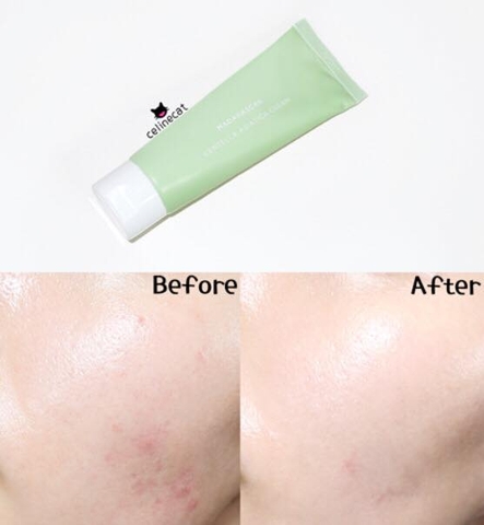 Kem dưỡng ẩm trị mụn, phục hồi Madagascar Centella Asiatica Cream