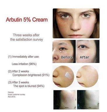 Kem ENCOS Arbutin 5% Cream Trị Nám, Tàn Nhang 15ml Hàn Quốc