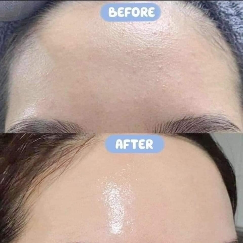 Tinh chất trẻ hoá da, dưỡng ẩm, giảm nhăn Christina Line Repair-Hydra-Theraskin+HA 30ml- Israel