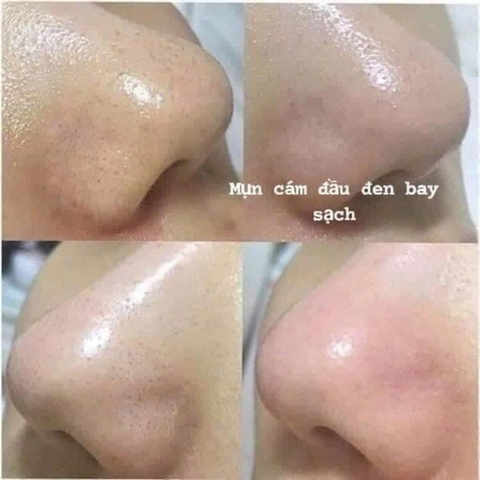 Gel Tẩy Da Chết Dưỡng Ẩm Và Làm Sáng Da Edally EX Hàn Quốc - Edally EX Smoothing Peeling Gel