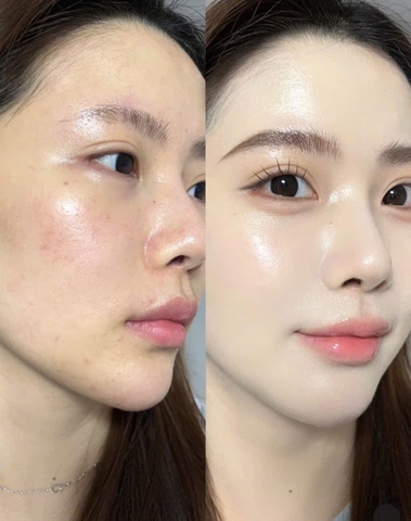 Kem Chống Nắng Phục Hồi & Tái Tạo Da Chuyên Sâu Civasan Balm Foam Lotion SPF50+ PA+++ 30ml