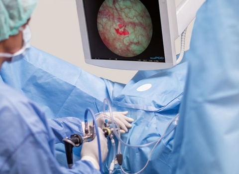 GIẢI PHÁP NGOẠI KHOA