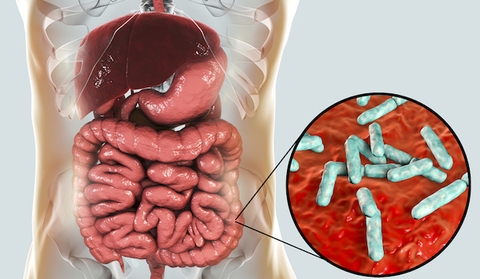 Mọi vấn đề về sức khỏe, bạn chỉ cần nhìn vào ruột của mình để biết câu trả lời