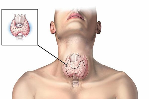 Tuyến tiền liệt