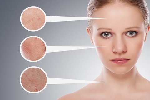 Trị nám - Trẻ hóa da - Xóa xăm công nghệ Laser Nano Plus