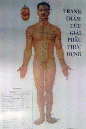 Tranh châm cứu giải phẫu thực dụng (12 tờ)