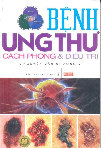 Bệnh ung thư - Cách phòng và điều trị