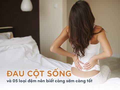 5 loại nệm cho người đau cột sống hiệu quả nhất hiện nay