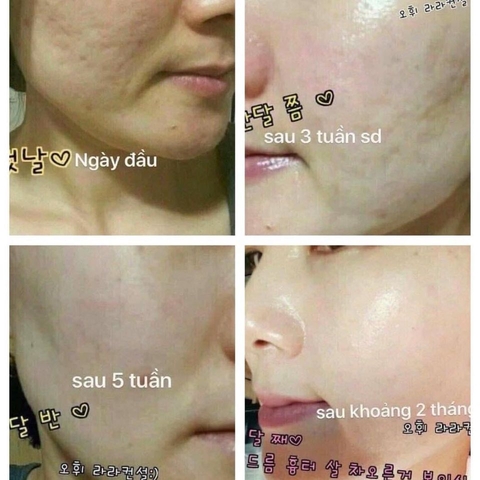 Tinh chất Vàng OHUI The First Ampoule Advanced 20ml