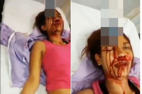 Dao đâm ngập đầu vẫn sống sót kỳ diệu