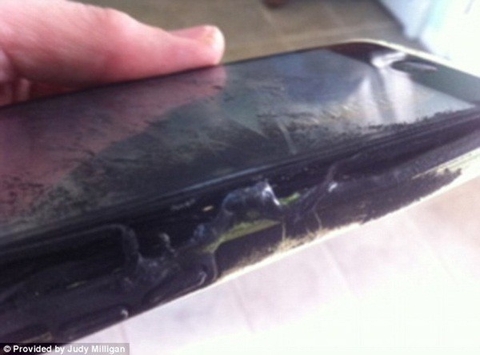 Teen girl bị phỏng mông vì iPhone bốc cháy trong túi quần sau