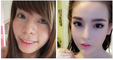 Ngỡ ngàng với ảnh trước và sau phẫu thuật của hot girl Vân Tokyo