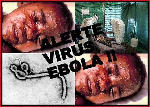 Đại dịch Ebola khủng khiếp đến mức nào, và làm sao để ngăn chặn?