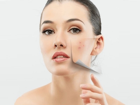 Peptide là gì? Công dụng tuyệt vời của Peptide với làn da của các chị em