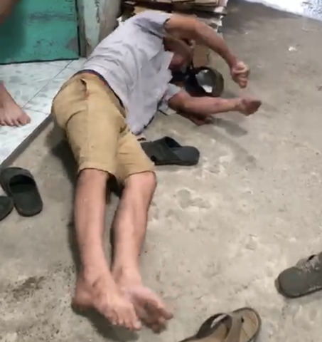 NHỮNG ĐIỀU CHƯA BIẾT VÀ CÁCH CHỮA DỨT BỆNH ĐỘNG KINH