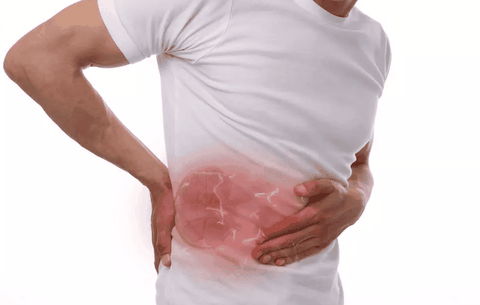 Sau Khi Mổ Sỏi Thận Bao Lâu Có Thể Quan Hệ Lại? Bác Sĩ Giải Đáp Rõ Ràng