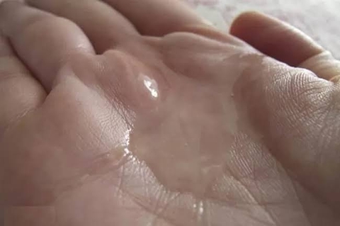 Cách Điều Trị Tinh Trùng Loãng: Làm Gì Để Tăng Cơ Hội Có Con?