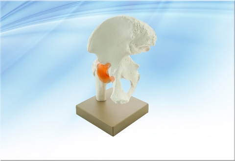 Mô hình xương khớp hông