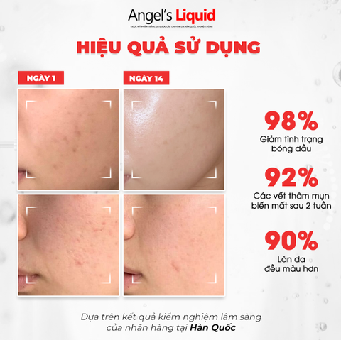 KEM LÀM TRẮNG, KIỂM SOÁT DẦU & THU NHỎ LỖ CHÂN LÔNG ANGEL'S LIQUID GLUTATHIONE PLUS NIACINAMIDE CICA CREAM 50ML
