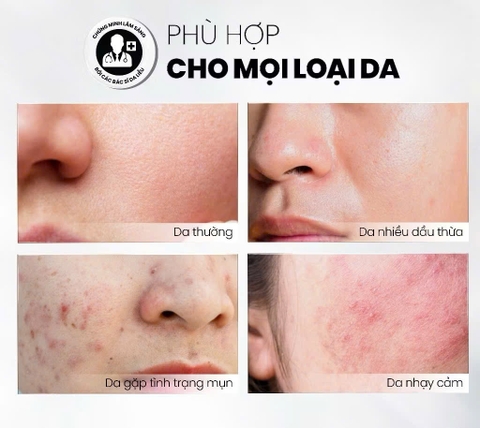 Tẩy Tế Bào Chết Home Peel Căng Bóng, Cấp Ẩm Và Làm Sáng Da MD Care Mande Exfo 30ml