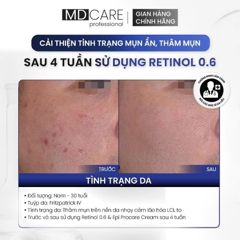 Kem Dưỡng Làm Sáng, Trẻ Hoá Và Cải Thiện Nếp Nhăn MD CARE PRO-RETINOL 30ml