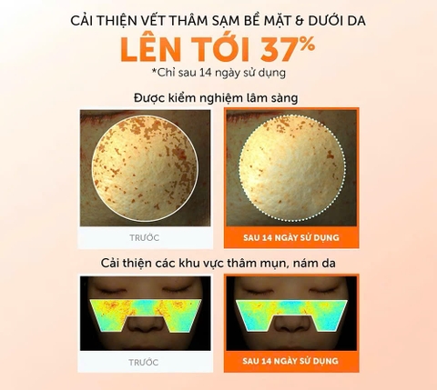 (Tặng toner Klairs mini 30ml tím) Dear, Klairs Nước hoa hồng hỗ trợ làm sáng da Freshly Juiced Vitamin Essence Toner 180ml