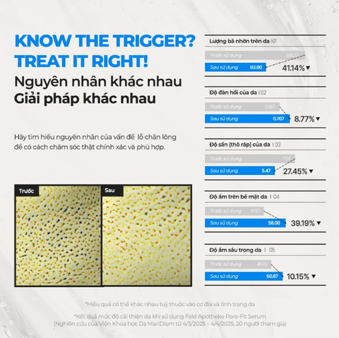 Tinh Chất Chăm Sóc Lỗ Chân Lông Feld Apotheke Pore-Fit Serum 50ml