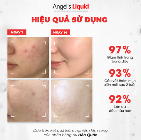 NƯỚC THẦN LÀM TRẮNG, KIỂM SOÁT DẦU & THU NHỎ LỖ CHÂN LÔNG ANGEL'S LIQUID GLUTATHIONE PLUS NIACINAMIDE CICA CREAM 150ML