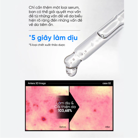 Tinh Chất Giảm Mụn Mờ Thâm Phục Hồi Da Mụn Feld Apotheke Phyto Calm Serum 30ml