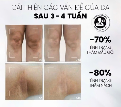 Sữa Dưỡng Thể Sáng Da Mờ Thâm MD CARE Brightening Booster Body Lotion 200ml