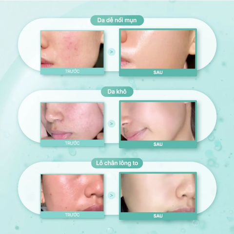 SOME BY MI INH CHẤT PDRN SKIN BOOSTER 50 ml