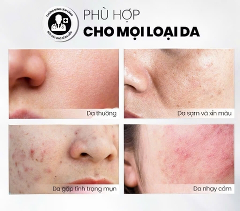 Tẩy Tế Bào Chết Home Peel Làm Sáng, Mờ Thâm Và Đều Màu Da MD Care Glow Exfo 30ml