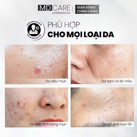 Sữa Rửa Mặt BHA Dạng Bọt MD CARE Dành Cho Da Dầu Mụn Nhạy Cảm 150ml